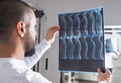 man looking at spinal x-rays
